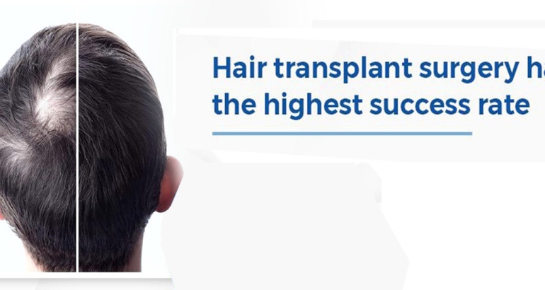 Hair Transplantation