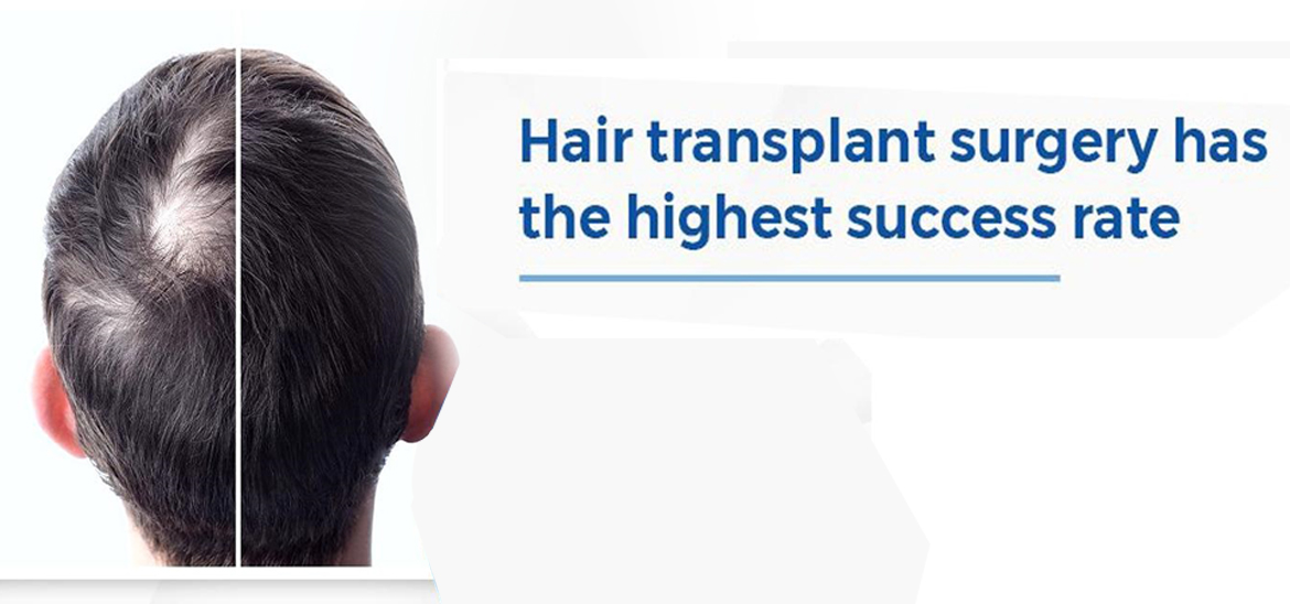 Hair Transplantation - Skin City India