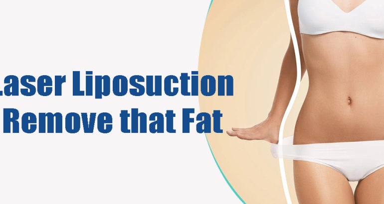 Liposuction