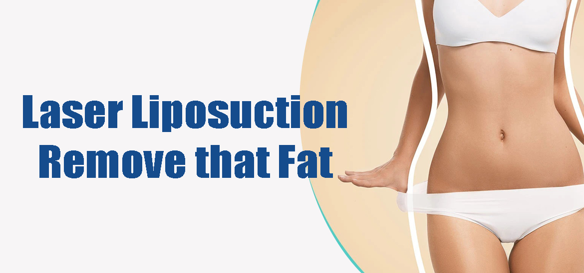 Liposuction