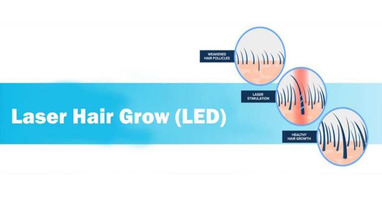 Laser Hair Grow