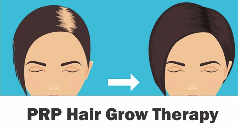 PRP Hair Grow Therapy