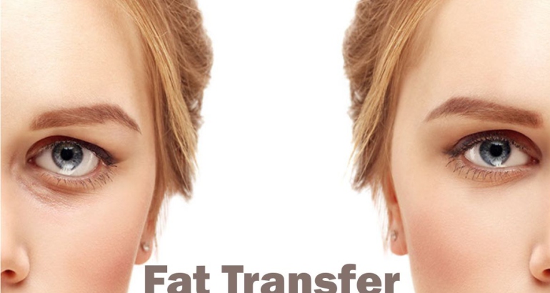 Fat Transfer