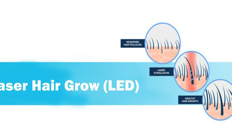 Laser Hair Grow