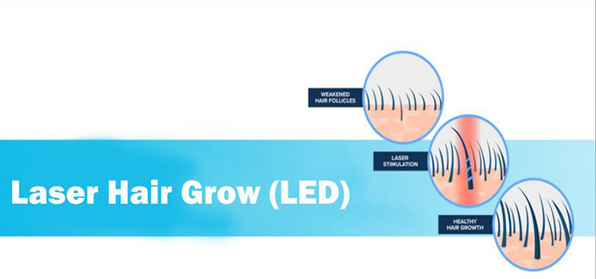 Laser Hair Grow