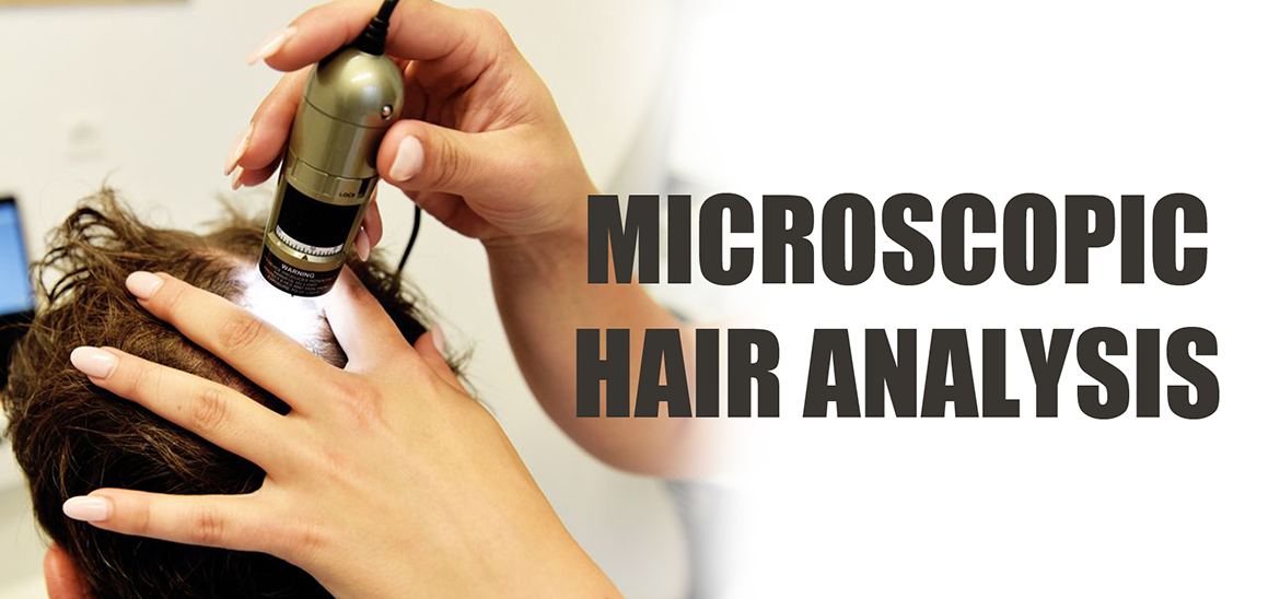 Microscopic Hair Analysis