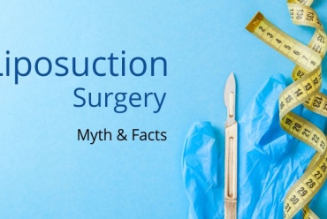 5 Liposuction Surgery Myth & Facts