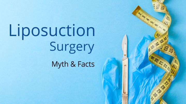 5 Liposuction Surgery Myth & Facts