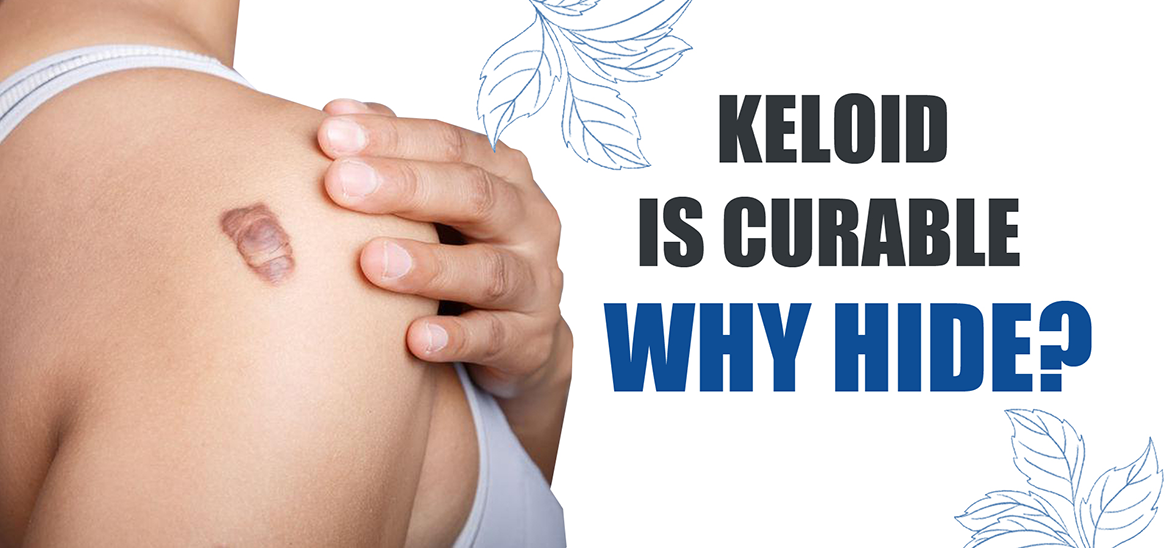 Keloid Clinic