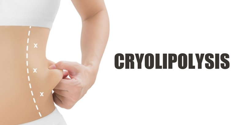 Cryolipolysis