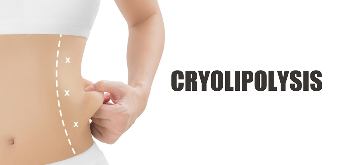 Cryolipolysis