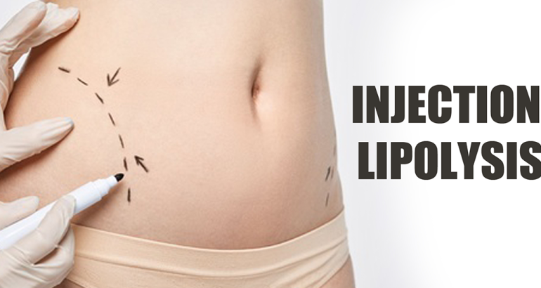 Injection lipolysis