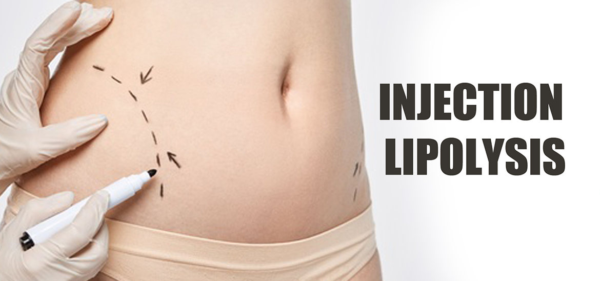 Injection lipolysis