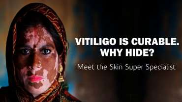 Vitiligo Clinic