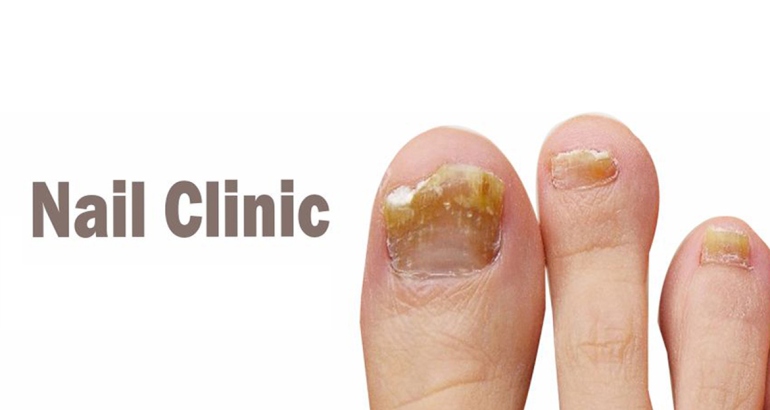 Nail Clinic