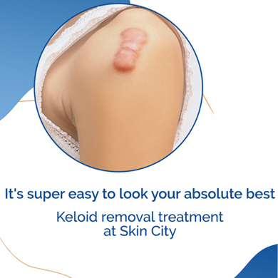KELIOD