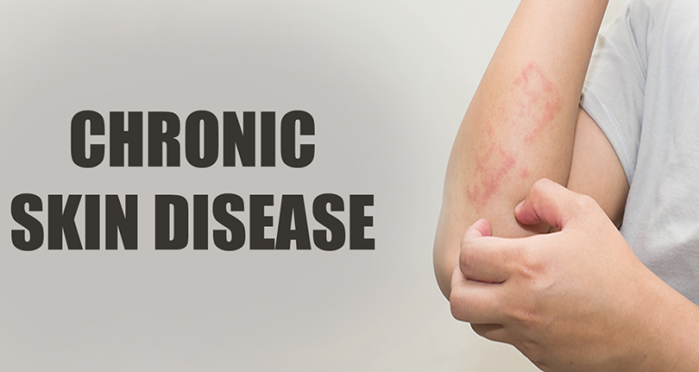 Chronic Skin Diseases Clinic