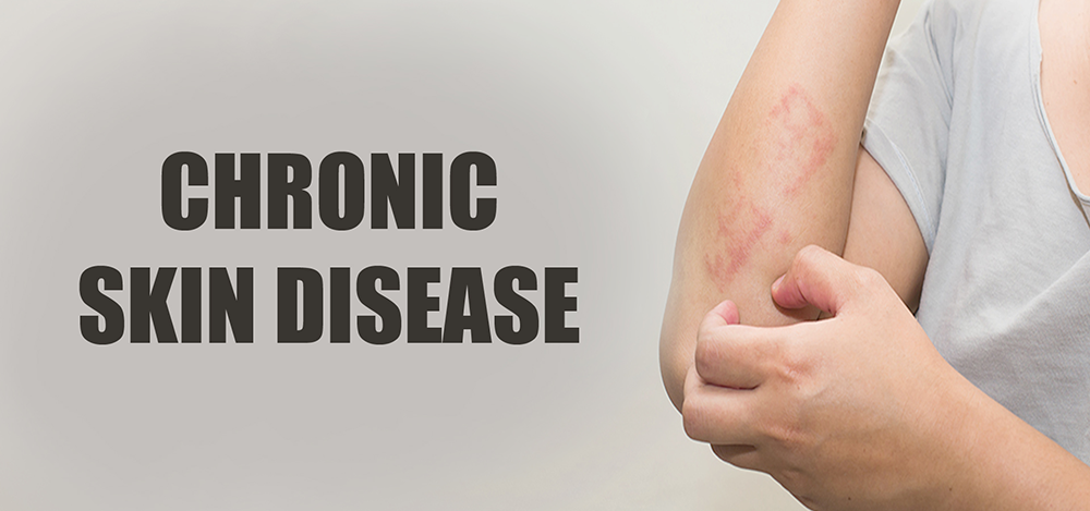 Chronic Skin Diseases Clinic